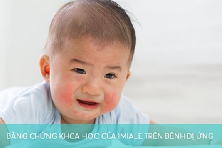 Lợi khuẩn Bifidobacterium BB12 cải thiện tình trạng dị ứng ở trẻ nhỏ 1 Bằng chứng khoa học của Imiale trên bệnh dị ứng 450 300