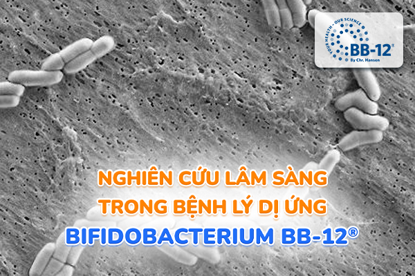 Nghiên cứu lâm sàng chứng minh hiệu quả của Bifidobacterium BB-12® trong bệnh lý dị ứng