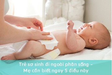 tre-so-sinh-di-ngoai-phan-song