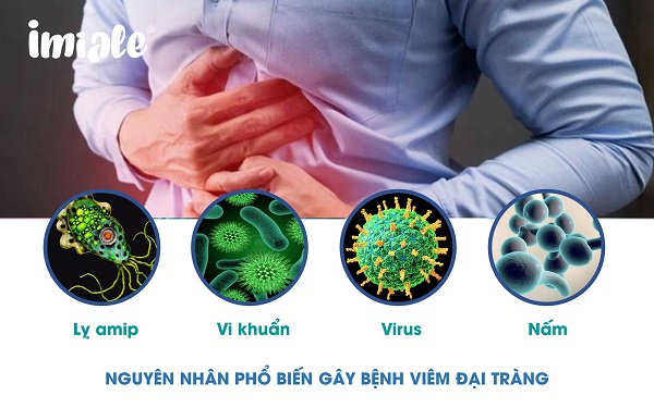 nguyen nhan gay benh viem dai trang