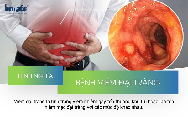 viem dai trang la gi