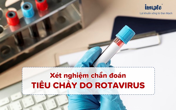 Xét nghiệm chẩn đoán rotavirus