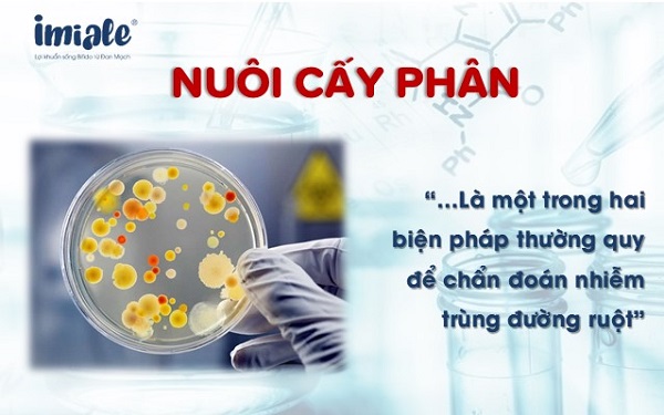 nuôi cấy phân để chẩn đoán nhiễm trùng đường ruột