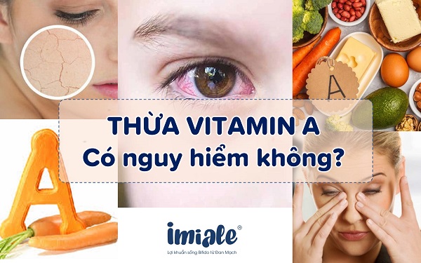 thừa vitamin A