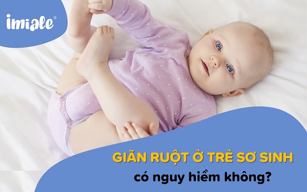 giãn ruột ở trẻ sơ sinh