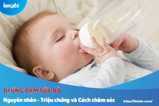 dị ứng đạm sữa bò