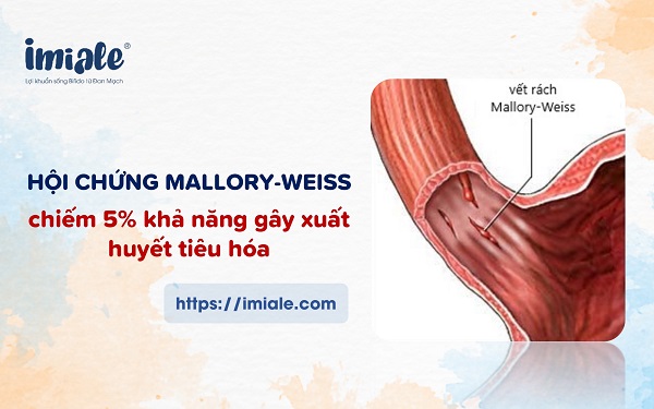 hội chứng Mallory-Weiss