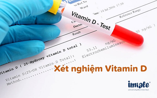 xét nghiệm vitamin D