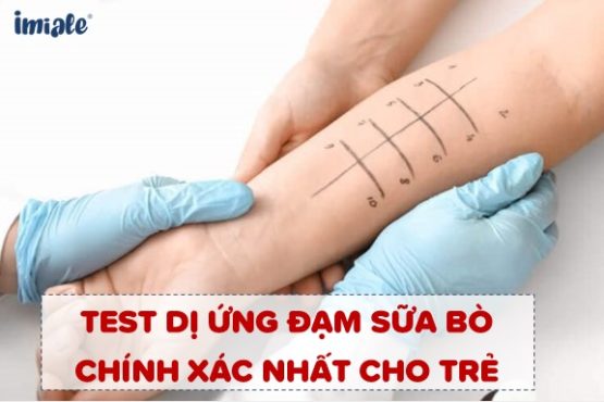 test dị ứng đạm sữa bò