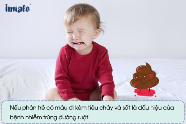 Trẻ sơ sinh đi ngoài phân thế nào là bất thường?